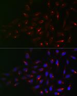 Vimentin Antibody in Immunocytochemistry (ICC/IF)