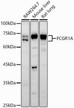 CD64 Antibody in Western Blot (WB)