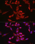 Bax Antibody in Immunocytochemistry (ICC/IF)