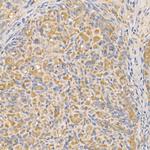 Bax Antibody in Immunohistochemistry (Paraffin) (IHC (P))