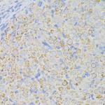 ACADL Antibody in Immunohistochemistry (Paraffin) (IHC (P))