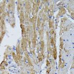 ACADL Antibody in Immunohistochemistry (Paraffin) (IHC (P))