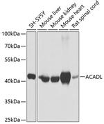 ACADL Antibody in Western Blot (WB)