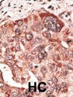 Recoverin Antibody in Immunohistochemistry (Paraffin) (IHC (P))