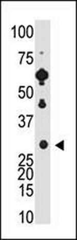 Recoverin Antibody in Western Blot (WB)