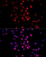 AMPK alpha-1,2 Antibody in Immunocytochemistry (ICC/IF)