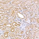 AMPK alpha-1,2 Antibody in Immunohistochemistry (Paraffin) (IHC (P))