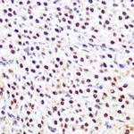 SP3 Antibody in Immunohistochemistry (Paraffin) (IHC (P))