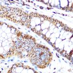 SP3 Antibody in Immunohistochemistry (Paraffin) (IHC (P))