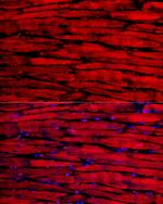 MYH6 Antibody in Immunocytochemistry (ICC/IF)