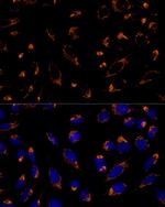 PRDX3 Antibody in Immunocytochemistry (ICC/IF)