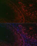 DAZL Antibody in Immunohistochemistry (Paraffin) (IHC (P))