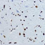 H4K12ac Antibody in Immunohistochemistry (Paraffin) (IHC (P))