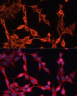 SLC25A23 Antibody in Immunocytochemistry (ICC/IF)