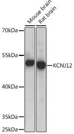 Kir2.2 (KCNJ12) Antibody in Western Blot (WB)