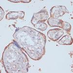 LRP1 Antibody in Immunohistochemistry (Paraffin) (IHC (P))