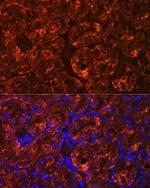 MIOX Antibody in Immunohistochemistry (Paraffin) (IHC (P))