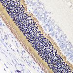 PDC Antibody in Immunohistochemistry (Paraffin) (IHC (P))