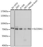 SLCO6A1 Antibody in Western Blot (WB)