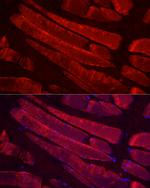 Myosin 4 Antibody in Immunocytochemistry (ICC/IF)