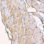 Myosin 4 Antibody in Immunohistochemistry (Paraffin) (IHC (P))