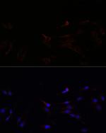 SUCLG1 Antibody in Immunocytochemistry (ICC/IF)