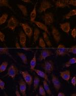 SUCLG1 Antibody in Immunocytochemistry (ICC/IF)