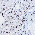 APC11 Antibody in Immunohistochemistry (Paraffin) (IHC (P))