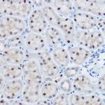 APC11 Antibody in Immunohistochemistry (Paraffin) (IHC (P))