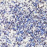 H2BK5ac Antibody in Immunohistochemistry (Paraffin) (IHC (P))