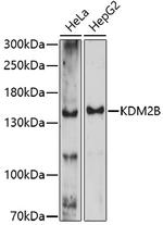 FBXL10 Antibody in Western Blot (WB)