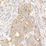 PGAM5 Antibody in Immunohistochemistry (Paraffin) (IHC (P))