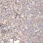 PGAM5 Antibody in Immunohistochemistry (Paraffin) (IHC (P))