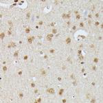 IGHMBP2 Antibody in Immunohistochemistry (Paraffin) (IHC (P))