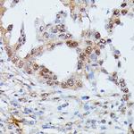 IGHMBP2 Antibody in Immunohistochemistry (Paraffin) (IHC (P))