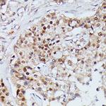 IGHMBP2 Antibody in Immunohistochemistry (Paraffin) (IHC (P))