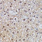 IGHMBP2 Antibody in Immunohistochemistry (Paraffin) (IHC (P))