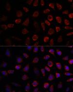 PDE11A Antibody in Immunocytochemistry (ICC/IF)