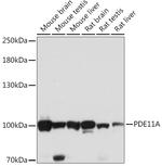 PDE11A Antibody in Western Blot (WB)