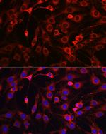 HMGCR Antibody in Immunocytochemistry (ICC/IF)