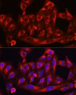 HMGCR Antibody in Immunocytochemistry (ICC/IF)