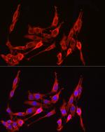 HMGCR Antibody in Immunocytochemistry (ICC/IF)