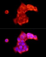 ATP6V0C Antibody in Immunocytochemistry (ICC/IF)