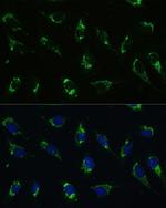 ATP5I Antibody in Immunocytochemistry (ICC/IF)