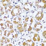 ATP5I Antibody in Immunohistochemistry (Paraffin) (IHC (P))