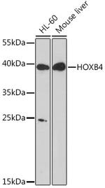 HOXB4 Antibody in Western Blot (WB)