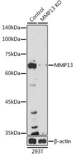 MMP13 Antibody in Western Blot (WB)