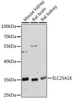 SLC25A16 Antibody in Western Blot (WB)