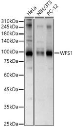 WFS1 Antibody in Western Blot (WB)