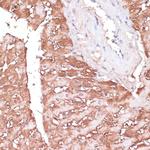 Gemin 5 Antibody in Immunohistochemistry (Paraffin) (IHC (P))